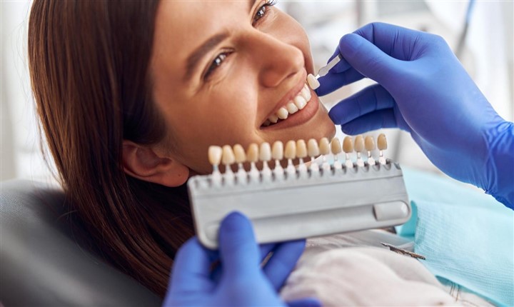 Dental Veneer